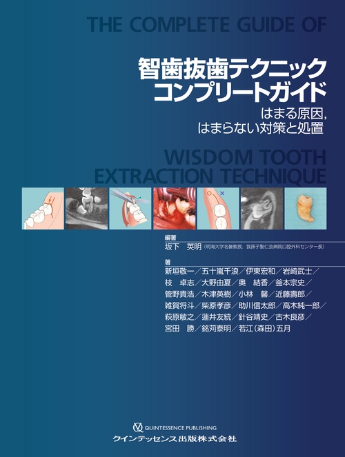 智歯抜歯テクニックコンプリートガイド