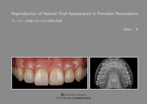 ポーセレン修復における生命感の表現
