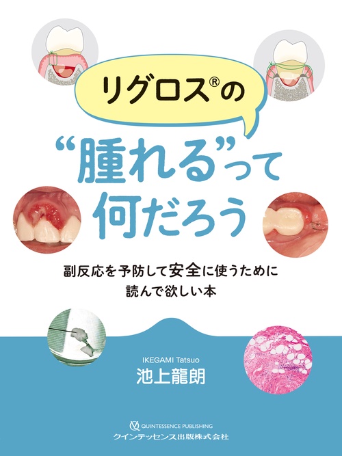 リグロス®の“腫れる”って何だろう