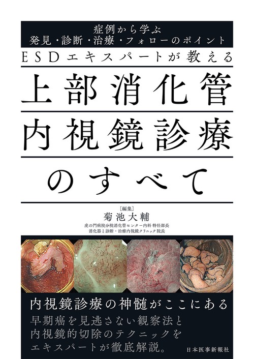 ESDエキスパートが教える　上部消化管内視鏡診療のすべて