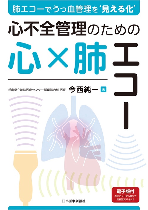 肺エコーでうっ血管理を‘見える化’　心不全管理のための心×肺エコー