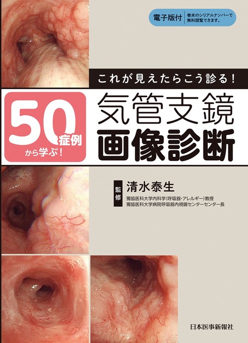 50症例から学ぶ！これが見えたらこう診る！気管支鏡画像診断