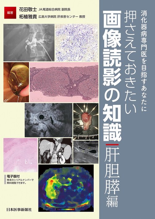 消化器病専門医を目指すあなたに　押さえておきたい画像読影の知識（肝胆膵編）