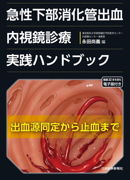 急性下部消化管出血　内視鏡診療実践ハンドブック