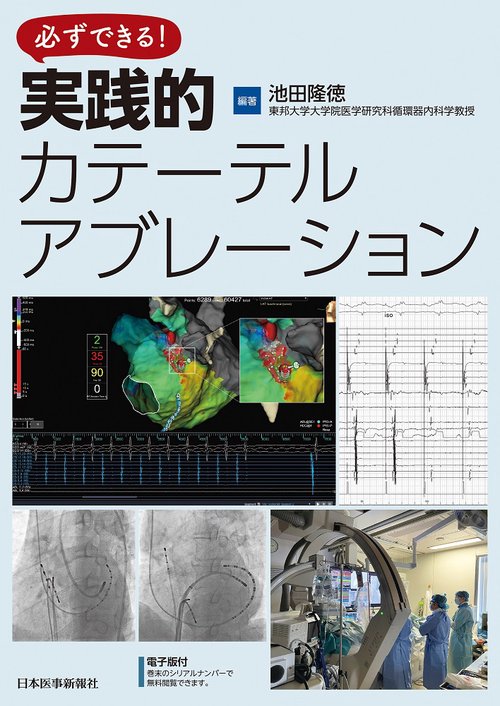 必ずできる！ 実践的カテーテルアブレーション