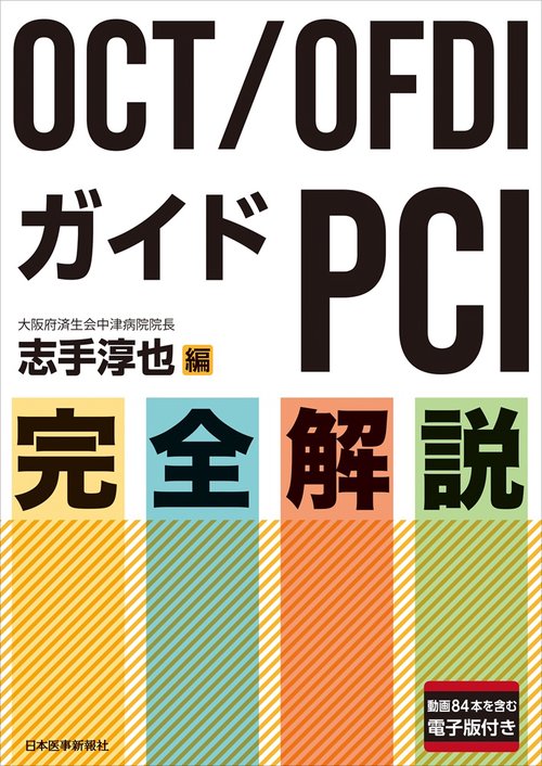 OCT/OFDIガイドPCI 完全解説