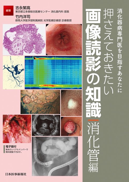 消化器病専門医を目指すあなたに　押さえておきたい画像読影の知識（消化管編）