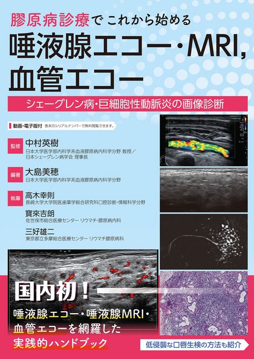 膠原病診療でこれからはじめる唾液腺エコー・MRI,血管エコー