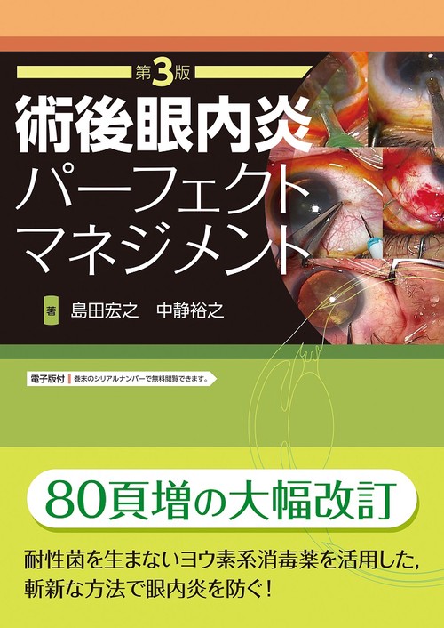 術後眼内炎パーフェクトマネジメント　第3版