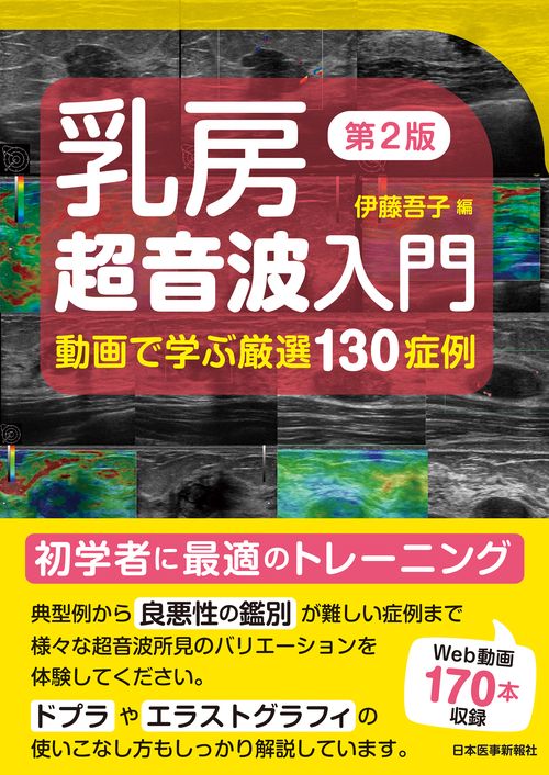 乳房超音波入門 第2版