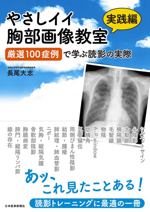 やさしイイ胸部画像教室【実践編】