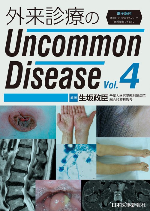 外来診療のUncommon Disease vol.4