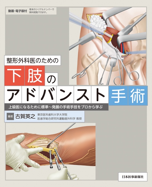 整形外科医のための下肢のアドバンスト手術