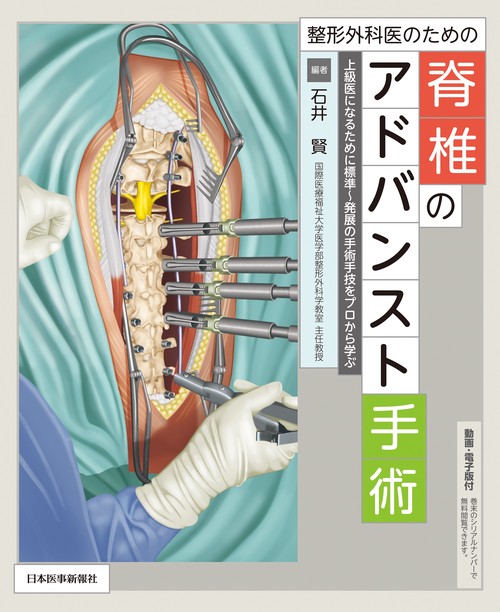 整形外科医のための脊椎のアドバンスト手術