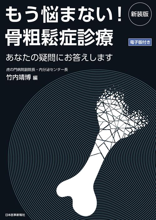 [電子版付] 新装版 もう悩まない！骨粗鬆症診療 あなたの疑問にお答えします