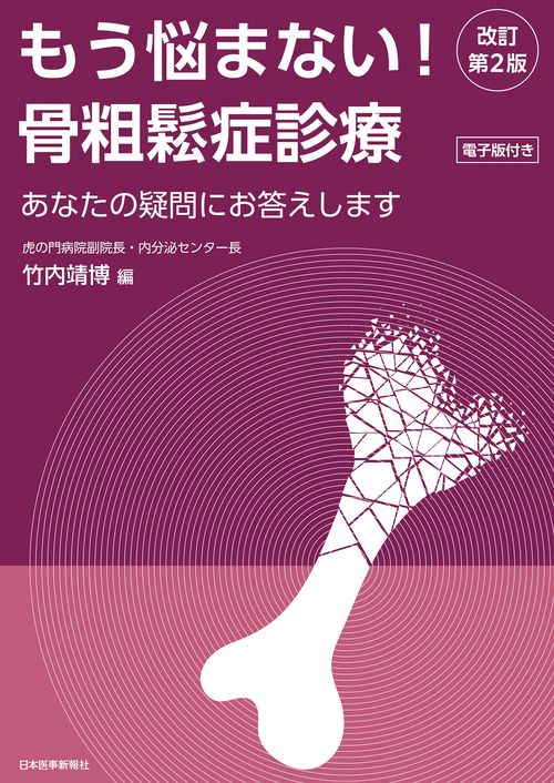 もう悩まない！骨粗鬆症診療 改訂第2版
