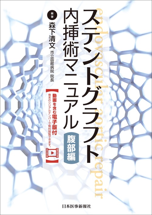 ステントグラフト内挿術マニュアル 腹部編【動画を含む電子版付】