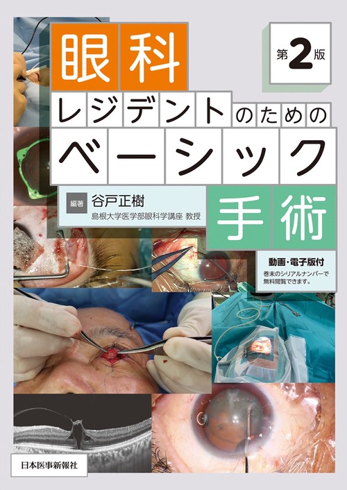 眼科レジデントのためのベーシック手術 第2版