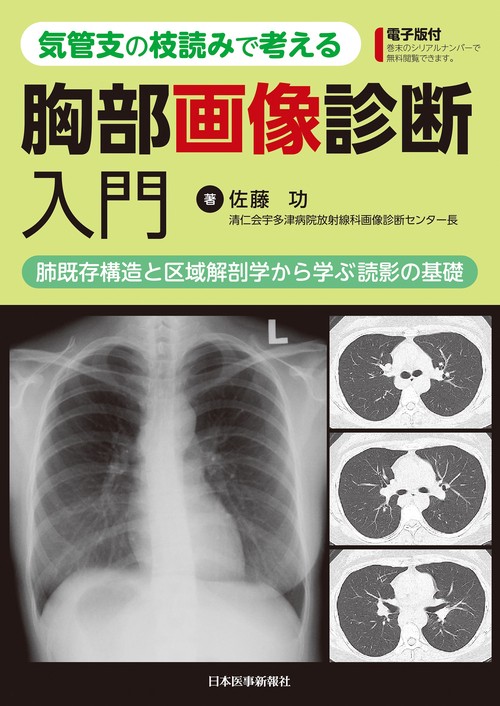 気管支の枝読みで考える 胸部画像診断入門　肺既存構造と区域解剖学から学ぶ読影の基礎【電子版付】