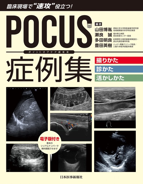 POCUS症例集 撮りかた、診かた、活かしかた