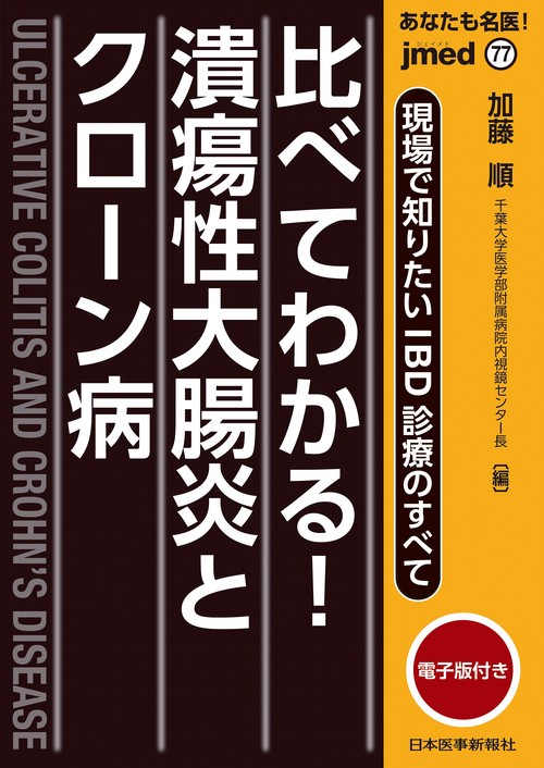 現場で知りたいIBD診療のすべて　比べてわかる！潰瘍性大腸炎とクローン病【電子版付】