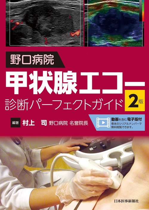 野口病院 甲状腺エコー診断パーフェクトガイド 第2版