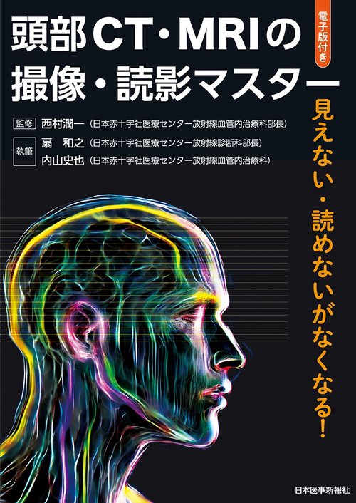 頭部CT・MRIの撮像・読影マスター