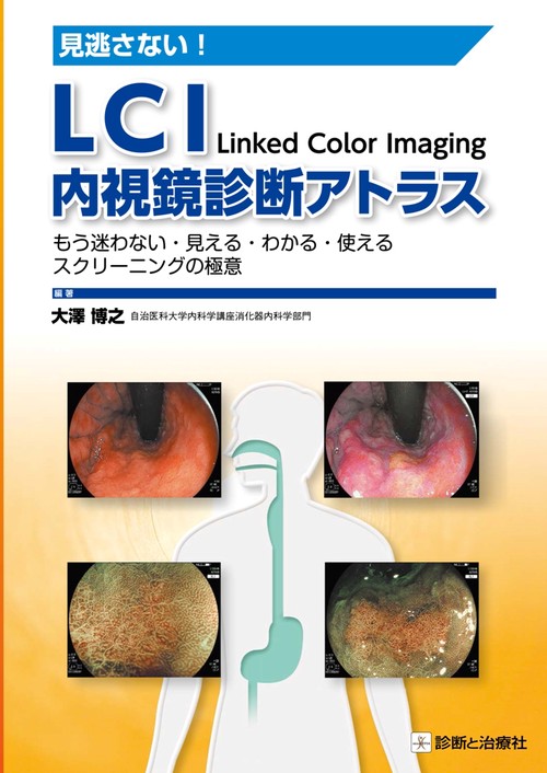 見逃さない！ＬＣＩ内視鏡診断アトラス