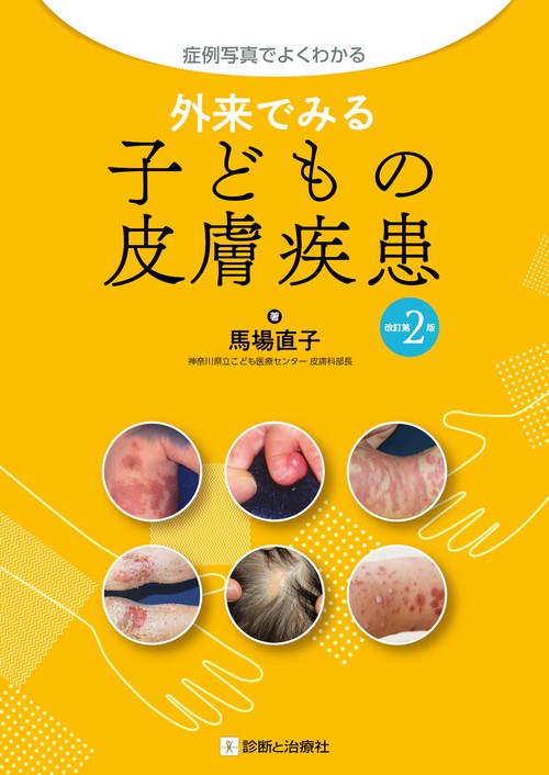 外来でみる子どもの皮膚疾患 改訂第2版