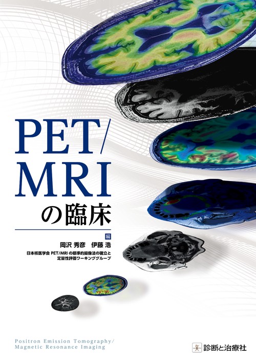PET／MRIの臨床