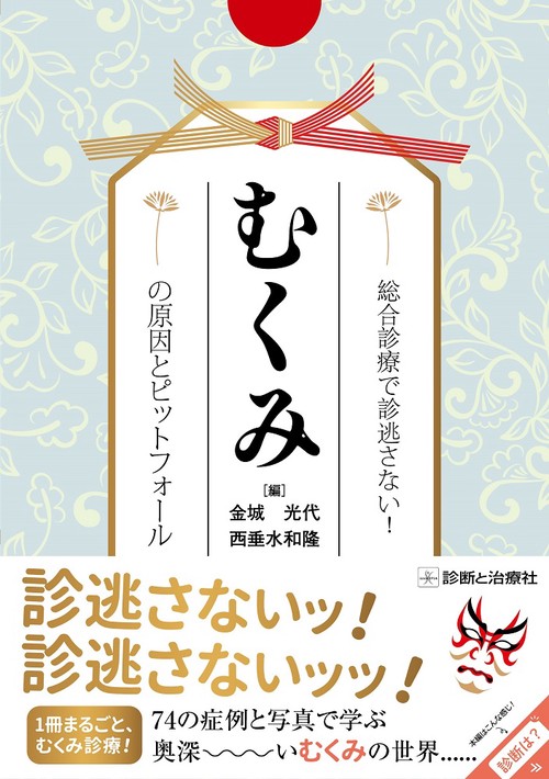 総合診療で診逃がさない！むくみの原因とピットフォール