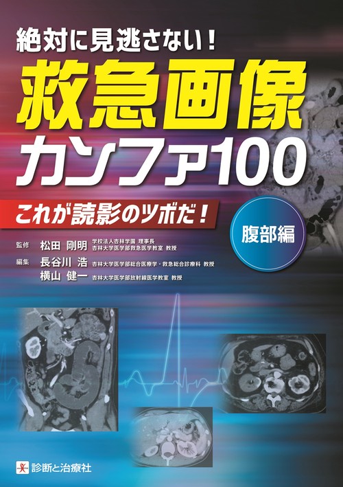 救急画像カンファ100（腹部編）