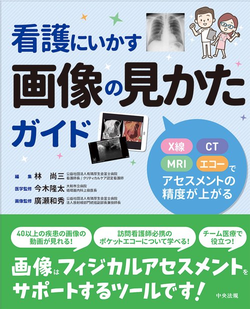 看護にいかす画像の見かたガイド