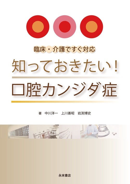 知っておきたい！口腔カンジダ症