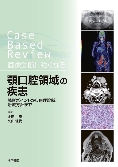 Case Based Review　画像診断に強くなる　顎口腔領域の疾患