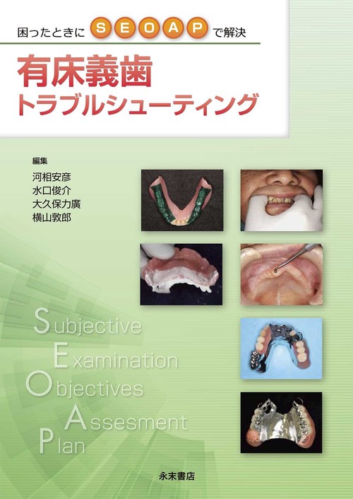 有床義歯トラブルシューティング