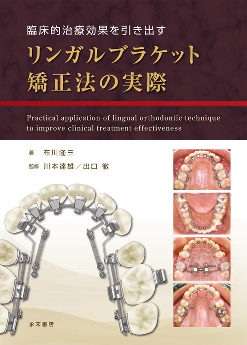 臨床的治療効果を引き出す　リンガルブラケット矯正法の実際