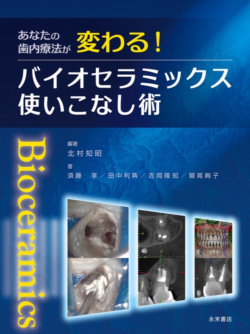 あなたの歯内療法が変わる！ バイオセラミックス使いこなし術