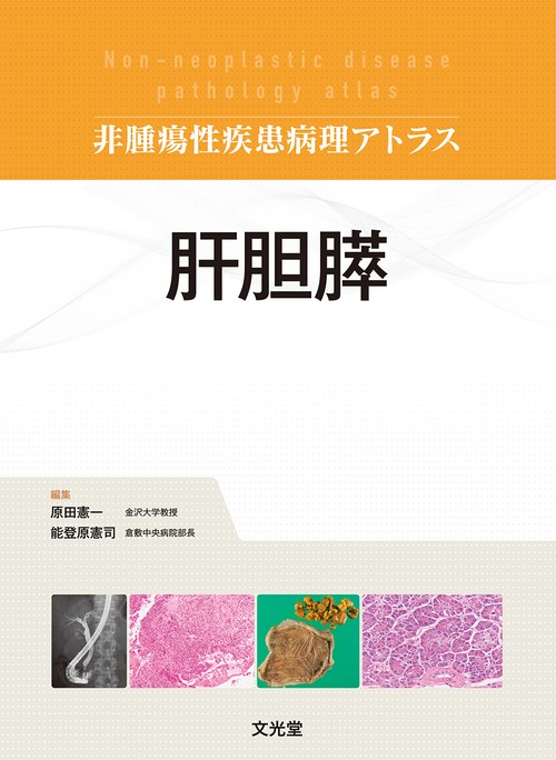 肝胆膵　(非腫瘍性疾患病理アトラス)