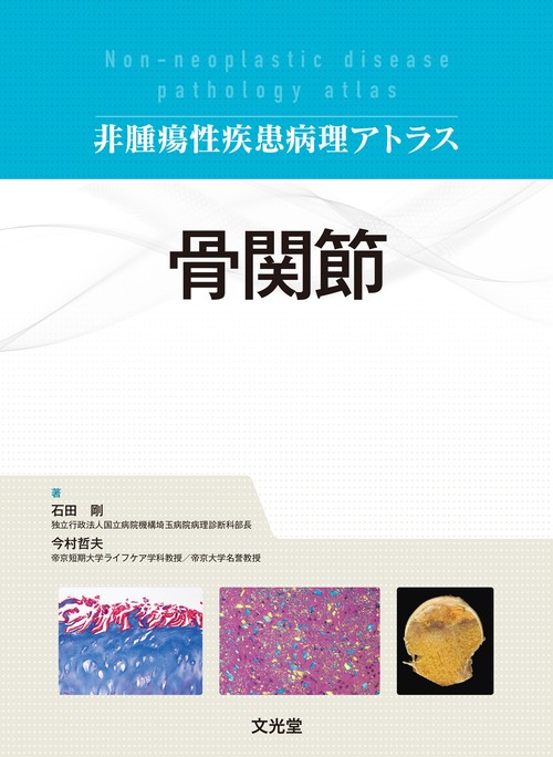 骨関節(非腫瘍性疾患病理アトラス)