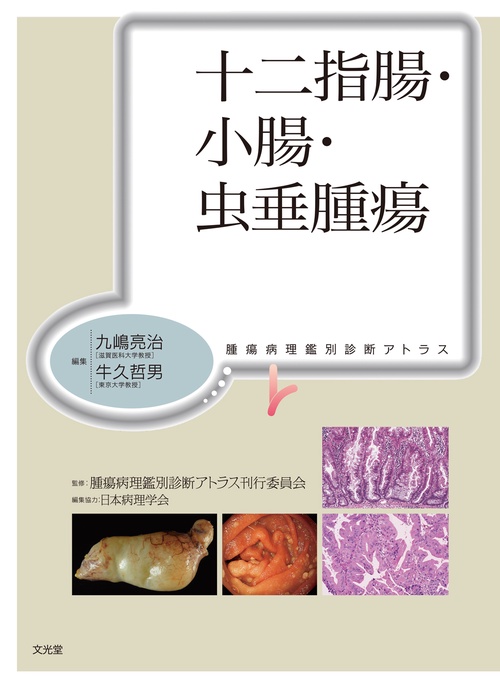 十二指腸・小腸・虫垂腫瘍