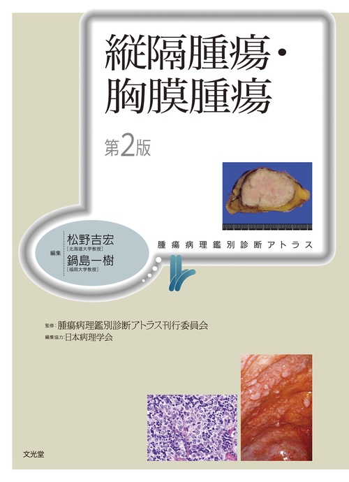 縦隔腫瘍・胸膜腫瘍