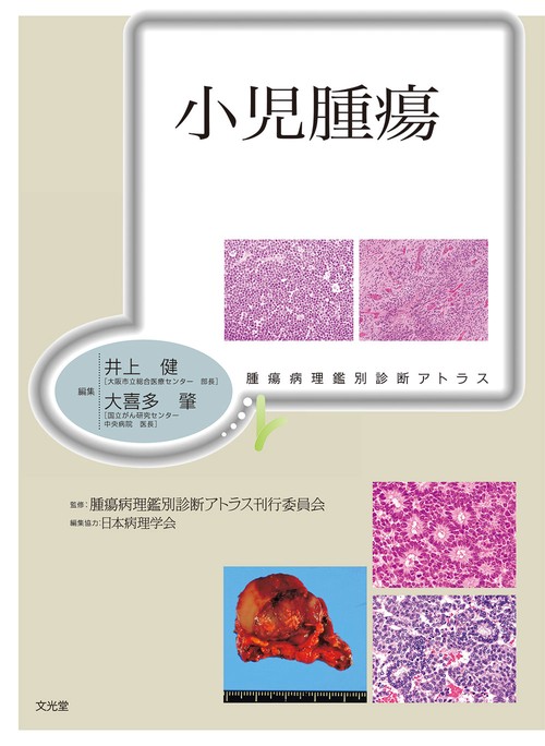 腫瘍病理鑑別診断アトラス　小児腫瘍
