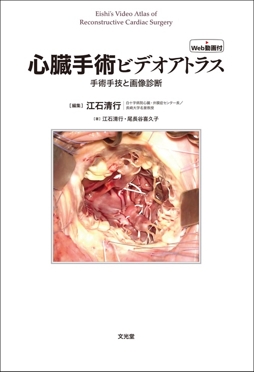 心臓手術ビデオアトラス　手術手技と画像診断［Web動画付］