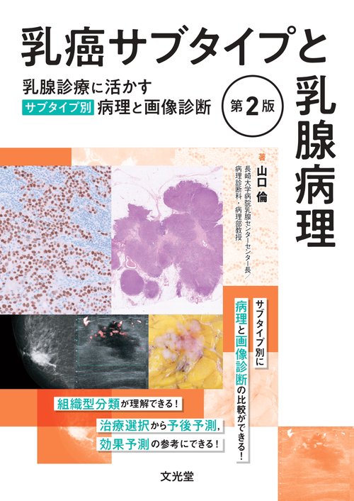 乳癌サブタイプと乳腺病理　第2版　乳腺診療に活かすサブタイプ別病理と画像診断