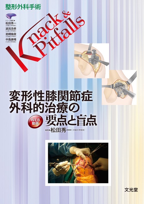 変形性膝関節症 外科的治療の要点と盲点