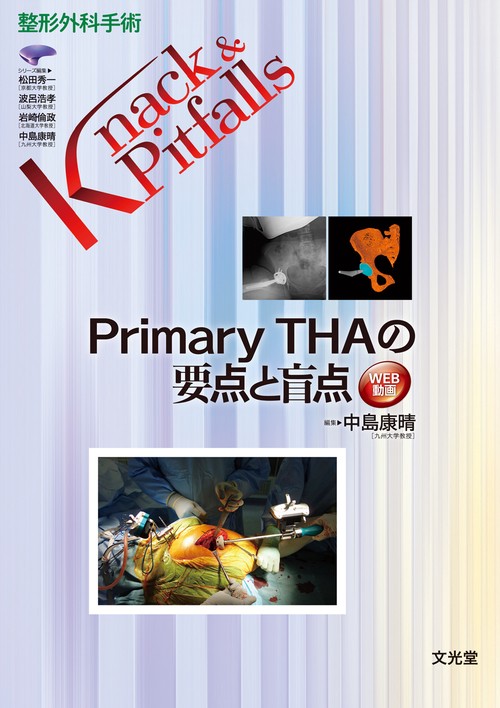 Primary THAの要点と盲点