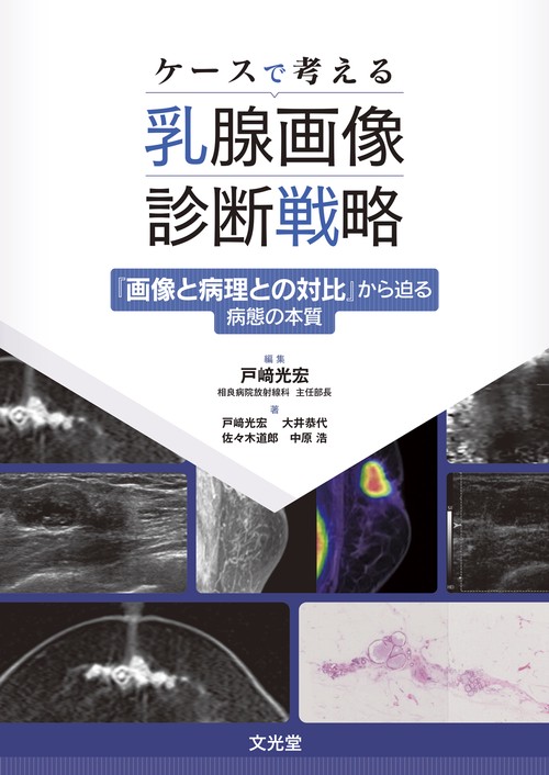 ケースで考える乳腺画像診断戦略