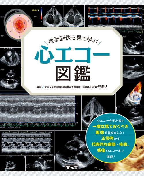 典型画像を見て学ぶ 心エコー図鑑