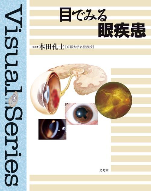目でみる眼疾患
